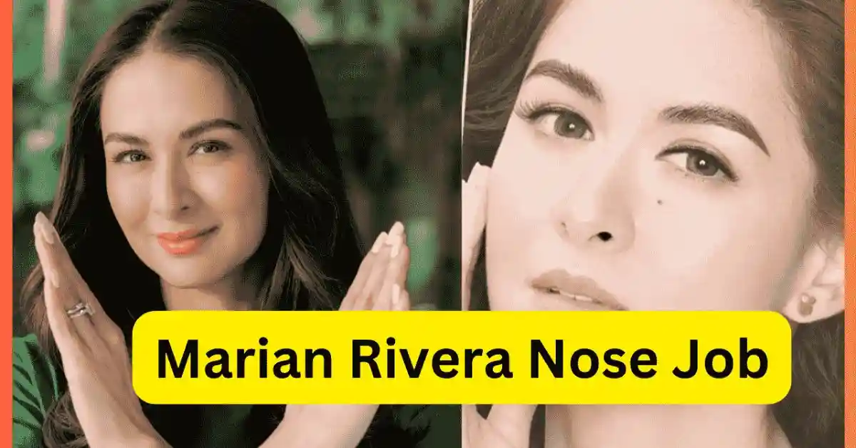 Marian Rivera Nose Job: Before and After Photos Revealed